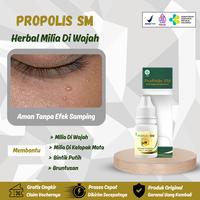 Gambar Cairan Oles Penghilang Milia Di Wajah Dan Gumpalan Lemak Di Kelopak Mata | Propolis Sm Isi 6 ml - Propolis Sm dari Adhitama.Herbal undefined 1 Tokopedia