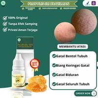 Gambar Salep Gatal Berair Menyebar Biang Keringat Anak dan Dewasa Biduran Gatal Bentol Kulit Ruam Gatal Seluruh Badan dari DanielHerbalShop undefined 1 Tokopedia