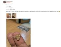 Gambar Propolis SM Tetes Polip Hidung, Konka hidung, Sinusitis, Pembersih Hidung - Ttes Propolis dari Safari Healthy undefined 3 Tokopedia