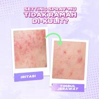 Gambar Dazzle Me Get A Grip Makeup Setting Spray Acne Soothing 60ml - Get Spray Acne dari Kios Branded_NEW undefined 3 Tokopedia