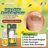 Gambar Obat Cantengan, Kuku Rusak Kuku Bernanah Bengkak Berdarah Jamur Kuku Cantengan Propolis SM Nail Kute dari Mitana Herbal undefined 1 Tokopedia