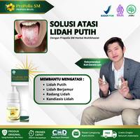 Gambar Propolis SM - Obat Lidah Putih Berjamur, Penyakit Kandidiasis Mukokutan Kronis, Infeksi Jamur, Sariawan Di Lidah, Radang Lidah, Kandiasis Lidah Atasi Dengan Propolis SM Isi 6ml dari Intan Herbal Store_NEW undefined 1 Tokopedia