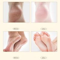 Gambar Hand Foot Cream Krim Kaki Tangan Anti Retak 60g Memperbaiki Kulit Pecah Kering Kasar - VP060 - VP060 dari inoutclothing undefined 4 Tokopedia