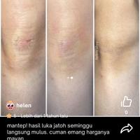 Gambar Japan Band-Aid Kizu Power Pad/Hydro Seal Standard Size 10 Pcs Best Seller dari Chalesh undefined 5 Tokopedia
