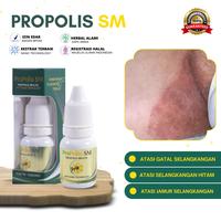 Gambar Propolis Sm Atasi Gatal Selangkangan Hitam Burik, Selangkangan Jamuran, Pemutih Selangkangan dari Nafiza herbal undefined 1 Tokopedia