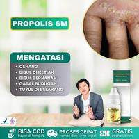 Gambar Propolis SM untuk cenang, Bisulan, Bisul di Ketiak, Bisul Bernanah, Bisulan Bernanah Di K3lamin, Bisul di Wajah Punggung, di Wajah, Di Kepala, di Telinga, Punggung, Paha dari Astrova Herbal undefined 1 Tokopedia