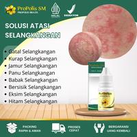 Gambar ProPolis Untuk Selangkangan Hitam Dan Gatal, Jamur Selangkangan, Gatal Selangkangan, Selangkangan Lecet, Psoriasis, Kulit Bersisik, Kurap, Gatal Selangkangan, Gatal Di Kelamin Dengan Propolis SM Brazilian Isi 6 ML dari Rino Herbal Shop undefined 1 Tokopedia