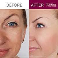 Gambar Retinol Instant Radiance Booster – The Original Retinol Glow Primer dari Beauty USA undefined 1 Tokopedia