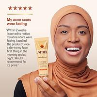 Gambar Ambi Skincare Fade Cream for Oily Skin | Dark Spot Remover dari Beauty USA undefined 5 Tokopedia