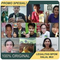 Gambar Obat Salep Selulitis, Di Apotik dari Obat Luka Diabetes dan Penurun Gula Darah Tinggi undefined 3 Tokopedia