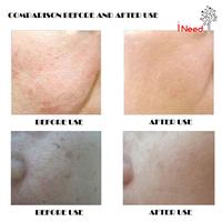 Gambar (T)erpopule(R) FOREO LUNA MINI 2 ~ Alat Pembersih Wajah ~ Facial Face Cleaner ~ Anti Aging dari muzaqi4608 undefined 5 Tokopedia