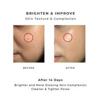 Gambar MSBB - Eucalie Organic AHA Water Gel Exfoliating Toner-Glowing & Brigh dari My Skin But Better undefined 4 Tokopedia
