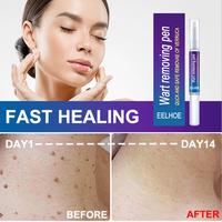 Gambar EELHOE Krim Penghilang Kutil 5Ml, Krim Penghilang Kutil Lalat Badan, dari DEA STORE NEWS undefined 2 Tokopedia