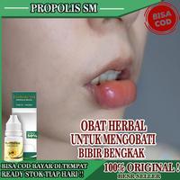 Gambar Obat Bengkak Bibir Obat Bibir Bengkak Alergi Obat Bibir Atas dari sinta dewi store undefined 1 Tokopedia