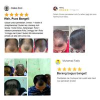 Gambar PAKET KIRKLAND MINOXIDIL 5 BIOTIN 10.000mcg isi 50 Obat Penumbuh dari dewanianjelika undefined 3 Tokopedia