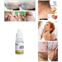 Gambar Skin Tag Remover - Obat Oles Kutil Mata Ikan & Tahi Lalat dari Warung Bu Nining undefined 2 Tokopedia