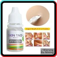 Gambar Mengatasi Kutil & Mata Ikan - Skin Tag Remover dari Warung Bu Nining undefined 1 Tokopedia