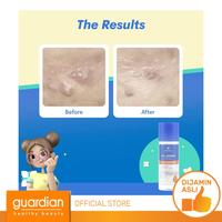 Gambar EMINA Ms Pimple Acne Solution Exfoliating Toner 100 ml dari Guardian Official Store undefined 4 Tokopedia