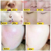 Gambar MESOWHITE BBGLOW dermawhite whitening glowing dari srkayu112 undefined 1 Tokopedia