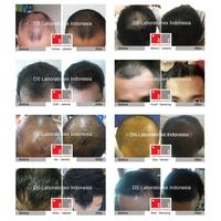 Gambar DS Laboratories - Spectral DNCS Penumbuh Rambut Herbal Terbaik di dari Berkahh Official undefined 3 Tokopedia