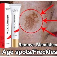 Gambar BPOM CINDYNAL Penghilang Flek Bintik Noda Hitam Whitening Freckle dari vonzy shop undefined 4 Tokopedia