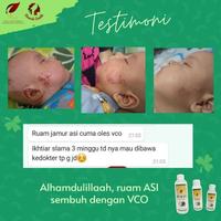 Gambar VCO Oil SR12 VICO Minyak Kelapa Murni 60ml 100ml 250ml Kapsul SR 12 - VCO 60ml dari Aliesa Tokopedia undefined 4 Tokopedia