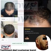 Gambar Bundle Kirkland Minoxidil  Nutrilabs Saw Palmetto Finastride dari ARINDRA_MART undefined 2 Tokopedia