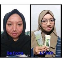 Gambar Promo paket glowing ala naturaworld Murah dari elvarette_ undefined 1 Tokopedia