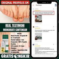 Gambar Obat Tetes Cantengan Tradisional Alami Cantengan Jempol Kaki Diskon dari nadya mustika_ undefined 5 Tokopedia