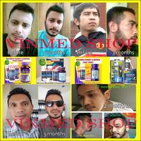 Gambar KIRKLAND MINOXIDIL 3 Botol BIOTIN 10.000mcg 100 Tabs PAKET IRIT dari mariyaadsya undefined 4 Tokopedia