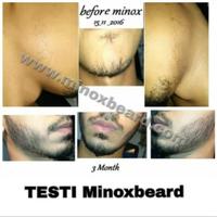 Gambar KIRKLAND MINOXIDIL BIOTIN PURITAN 7500MCG 100 TAB - Nutrilabs dari liam jkt undefined 4 Tokopedia