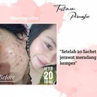 Gambar Collagen Drink POMEGLOW, BPOM aman busui bumil (FREE GIFT) dari areta ayu undefined 4 Tokopedia