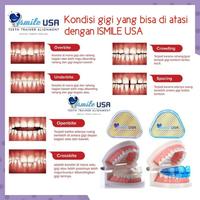 Gambar Ismile USA original Perapih gigi ismile Usa original Perapi gigi dari Kenzie Jiwanta undefined 2 Tokopedia