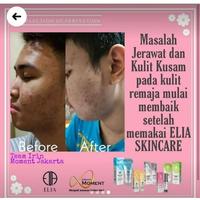 Gambar ELIA SKINCARE KOREA paket BASIC WHITENING CREAM BEBAS FLEK HITAM dari maulidaeshal undefined 4 Tokopedia