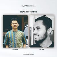 Gambar Yamani Beard Growth Serum 30 ml - Serum Penumbuh Brewok Berkualitas dari barastore203 undefined 3 Tokopedia