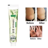 Gambar ZUDAIFU SALEP OBAT ORIGINAL UNTUK ALERGI GATAL JAMURAN JERAWAT EKSIM - SACHET 5PCS dari RUKO NUR undefined 4 Tokopedia