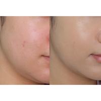 Gambar Wardah INSTAPERFECT Skin Cover AIR CUSHION Kemasan Baru - REFILL CUS33 dari Kathlee Beauty undefined 4 Tokopedia