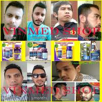 Gambar Paket Hemat Kirkland Minoxidil 5Biotin 10.000mcg - Pipet original dari citraayukirana undefined 3 Tokopedia