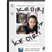 Gambar paket 2 btl Minoxidil Kirkland signature 5 topical USA untuk 2 bulan dari vania shop-0 undefined 3 Tokopedia