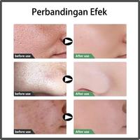Gambar Pelembab wajah pria Cream pembutih wajah Moisturizer cream Pelembab dari Blue Eyelash undefined 5 Tokopedia