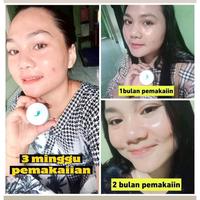 Gambar PAKET SKINNAZA MALAM EKTRA ORIGINAL dari BarsStore1232 undefined 4 Tokopedia
