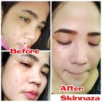 Gambar PAKET SKINNAZA MALAM EKTRA ORIGINAL dari BarsStore1232 undefined 3 Tokopedia