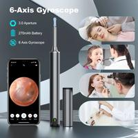 Gambar Smart Visual Ear Sticks Otoscope Endoscope HD Wax Removal Tool dari Barrett Import undefined 2 Tokopedia