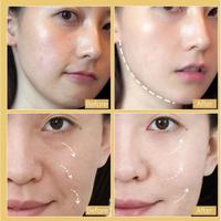 Gambar [ORIGINAL] VSHILIL GOLD PROTEIN LINE PEPTIDE Tanam Benang Tanpa Jarum dari Awak Beauty undefined 4 Tokopedia