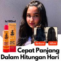 Gambar `Terbaru~ Shampoo Metal Fortis Obat Pemanjang Rambut Cowok Penumbuh Botak Dengan Super Cepat Pria Wanita Rontok Parah Biar Panjang Buat Panjangin Rambut Cowok Pelebat Tercepat Ampuh Sampo Penyubur Agar Tebal Sampoo Buat Manjangin Anti Rontok Anti Ketombe dari rosaliane store undefined 1 Tokopedia