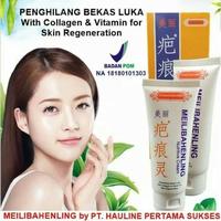 Gambar Meilibahenling Nutrive Cream Salep Penghilang Bekas Luka dari Yasashi Zr undefined 3 Tokopedia