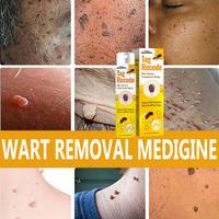 Gambar PENGHILANG TAHI LALAT DI WAJAH PENGHILANG KUTIL DI LEHER WART REMOVAL TAG RECEDE PENGHILANG KUTIL DAN TAHI LALAT OBAT KUTIL PALING AMPUH SKIN TAG REMOVER BEE VENOM TREATMENT SPRAY - 1PC=20ml dari ayam penyet dalq undefined 2 Tokopedia