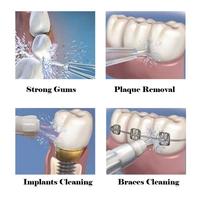 Gambar PTR Dental Flosser Water Floss Pembersih Scaling Behel Gigi Waterpulse dari jenatashop undefined 2 Tokopedia