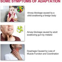 Gambar Portable Choking Rescue Device Emergency Life Saving Airway Assist dari TOKOTOPIANAKGRS 455 undefined 1 Tokopedia