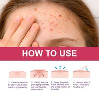 Gambar 1 Bag/144pcs Mini Star Invisible Acne Removal Pimple Patch Beauty Face Acne Spot Face Pimple Acne Skin Concealer Tool Stickers dari Ikah Toys undefined 5 Tokopedia